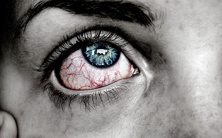 Røde øjne: 5 årsager, du bør kende til